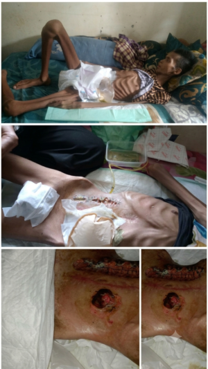 MELALUI AJMI ,KELUARGA MUHAMMAD RIZKY AQBAR MOHON BANTUAN PENGOBATAN KE RUMAH SAKIT TNI
